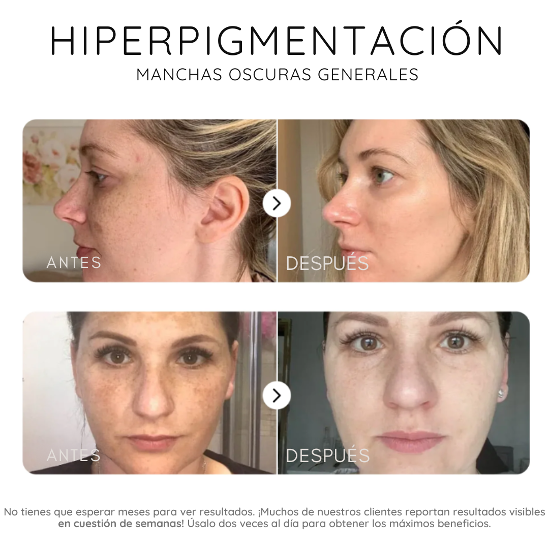 Serum corrector de manchas oscuras