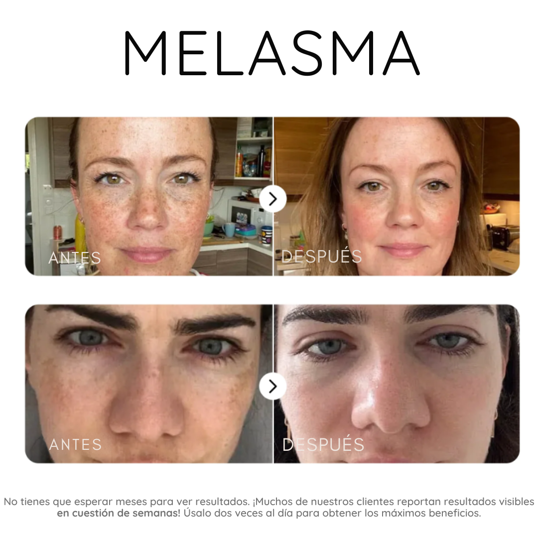 Serum corrector de manchas oscuras