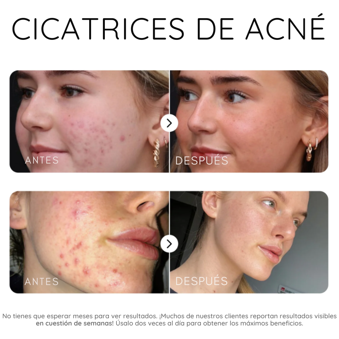Serum corrector de manchas oscuras
