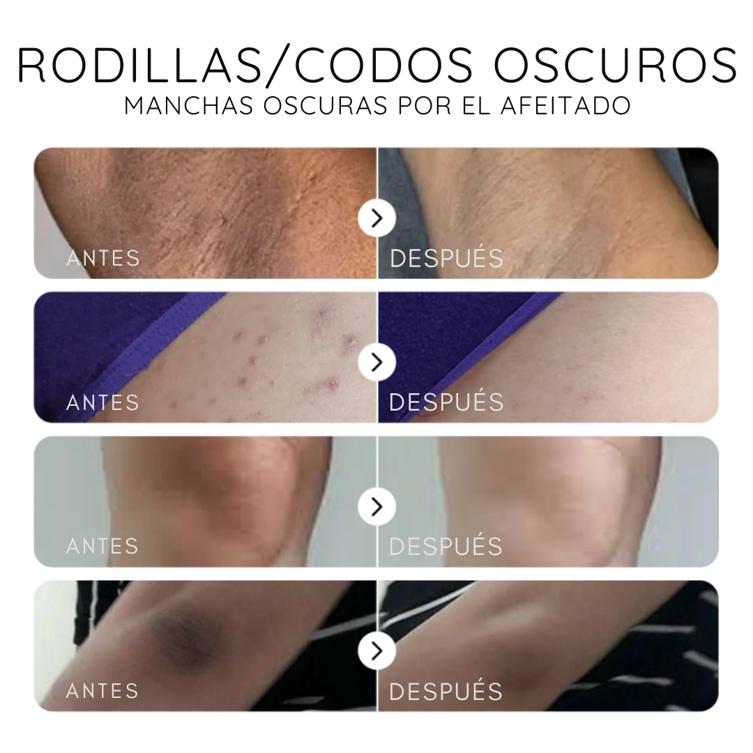 Serum corrector de manchas oscuras