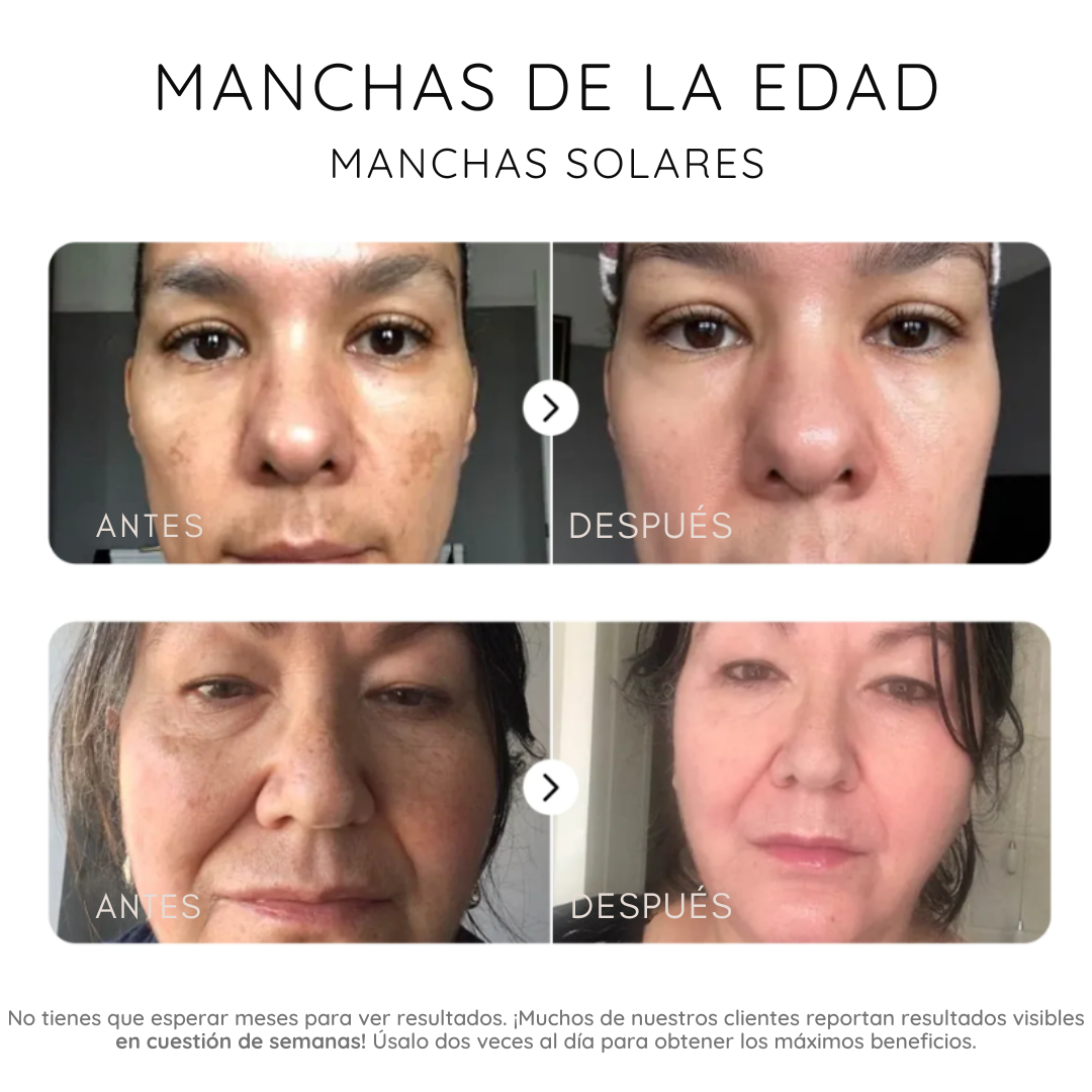 Serum corrector de manchas oscuras