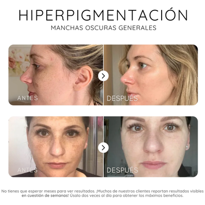 Serum corrector de manchas oscuras